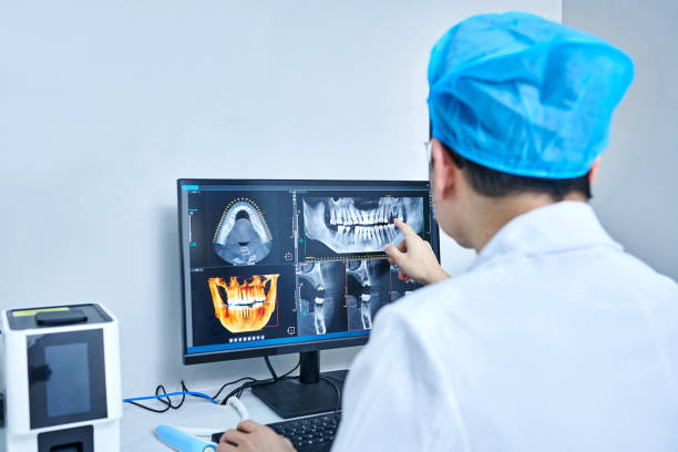 Best Emergency Wisdom Teeth Removal in Tladega, AL