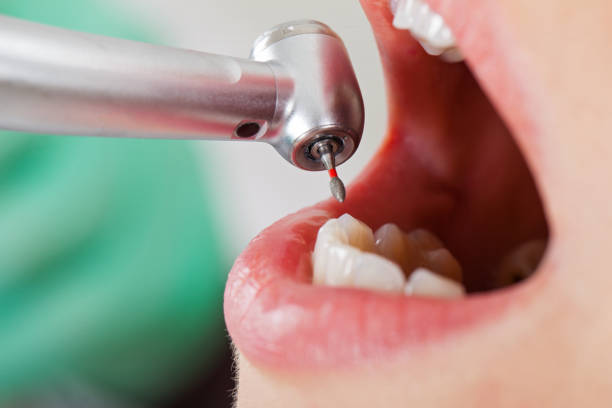 Best Emergency Dental Surgery in Tladega, AL